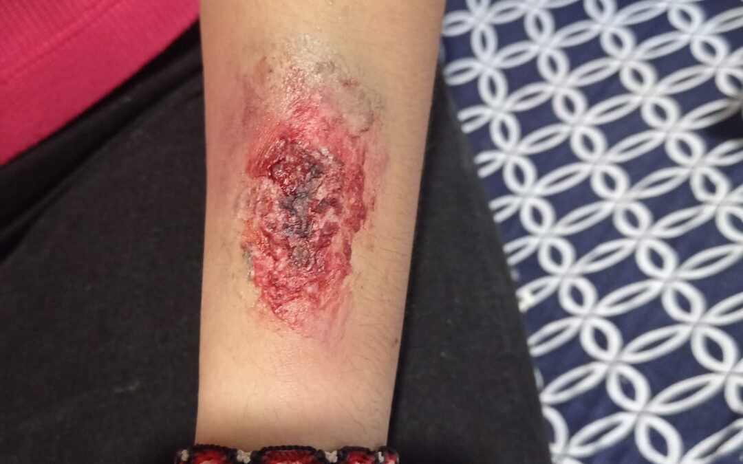 Maquillaje de heridas
