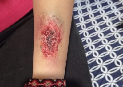 Maquillaje de heridas
